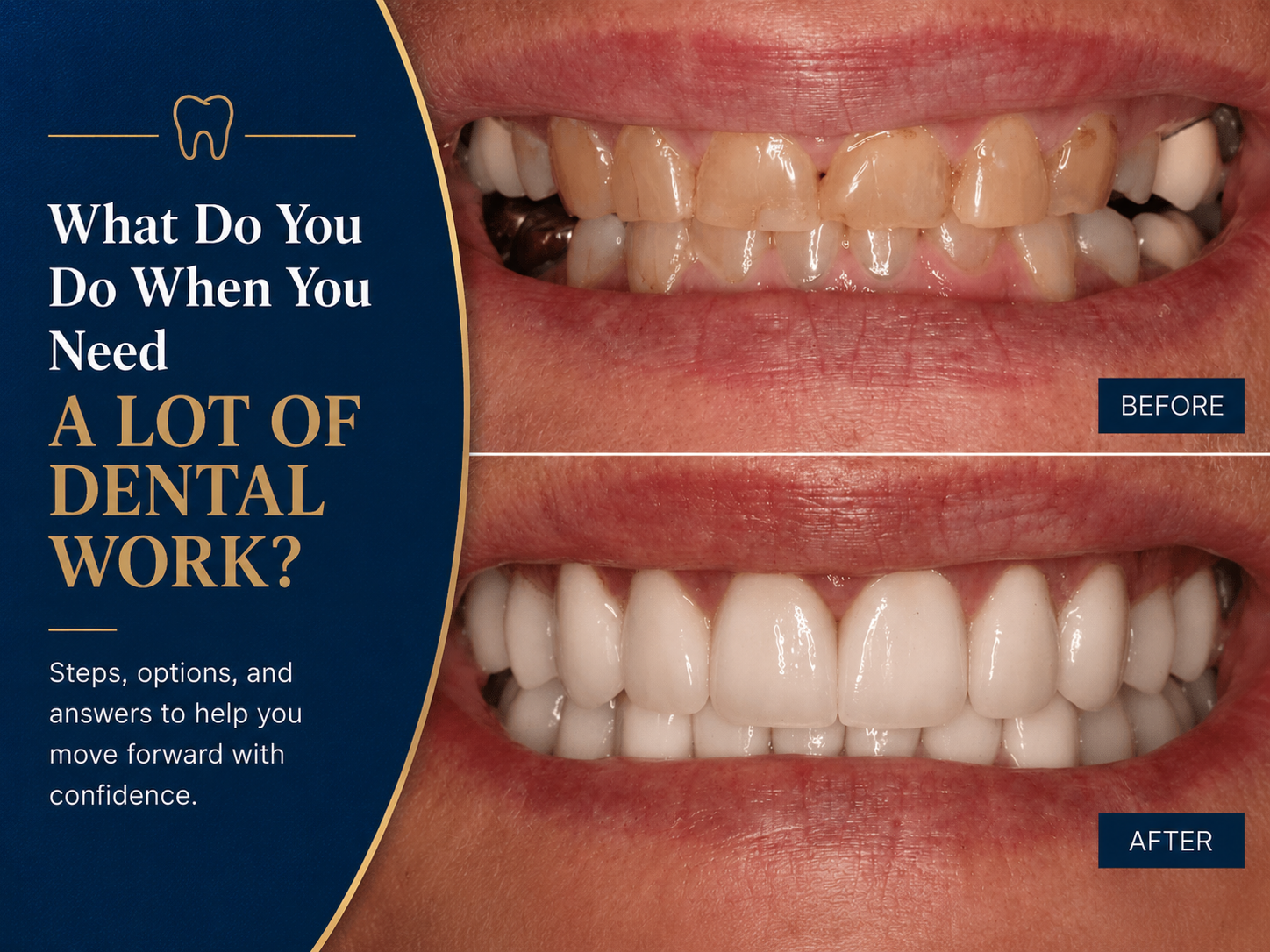 What Do You Do When You Need a Lot of Dental Work?