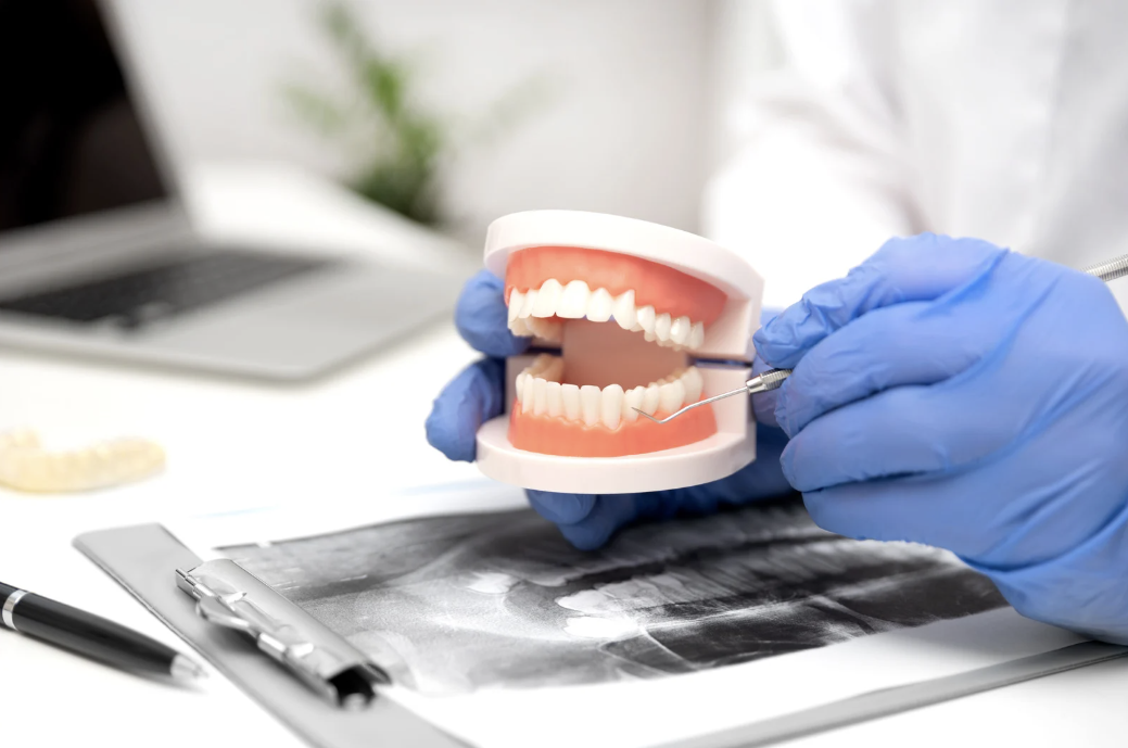 What Procedures Are Included in a Full Mouth Reconstruction?