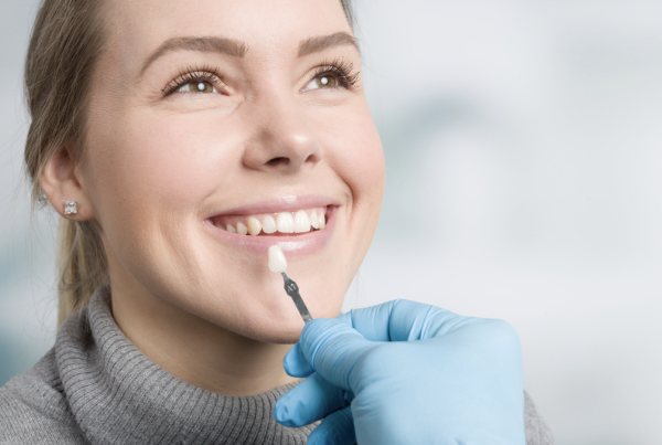 How to Avoid Fake-Looking Veneers