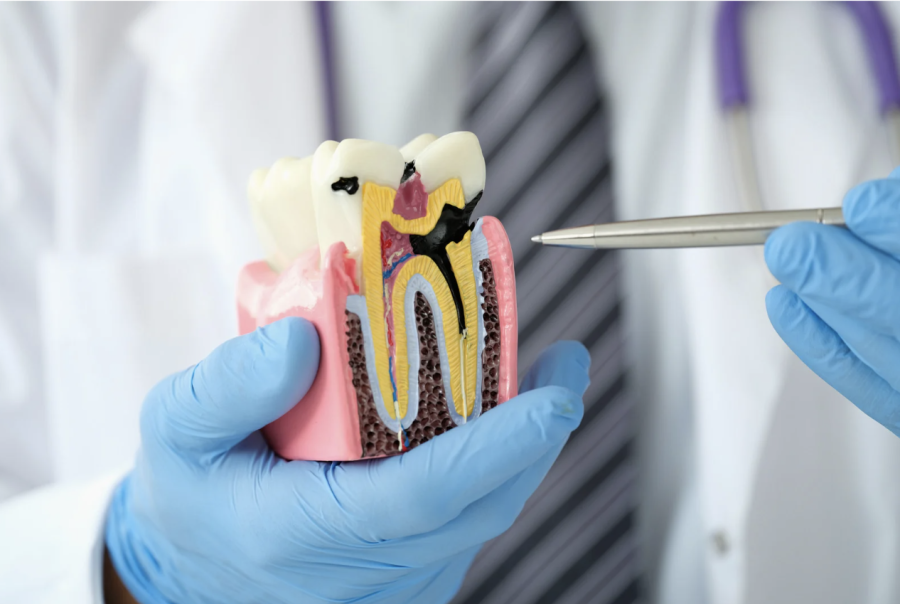 How to Prevent Cavities from Getting Worse