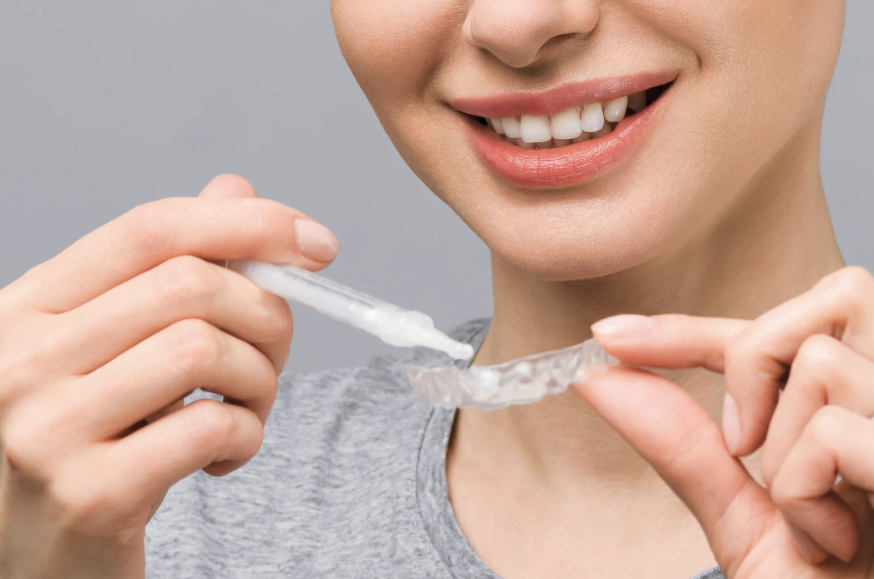 Teeth Whitening for Sensitive Teeth: Is It Safe?