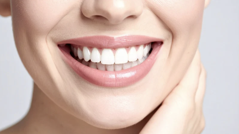 Do You Need Straight Teeth for Veneers?