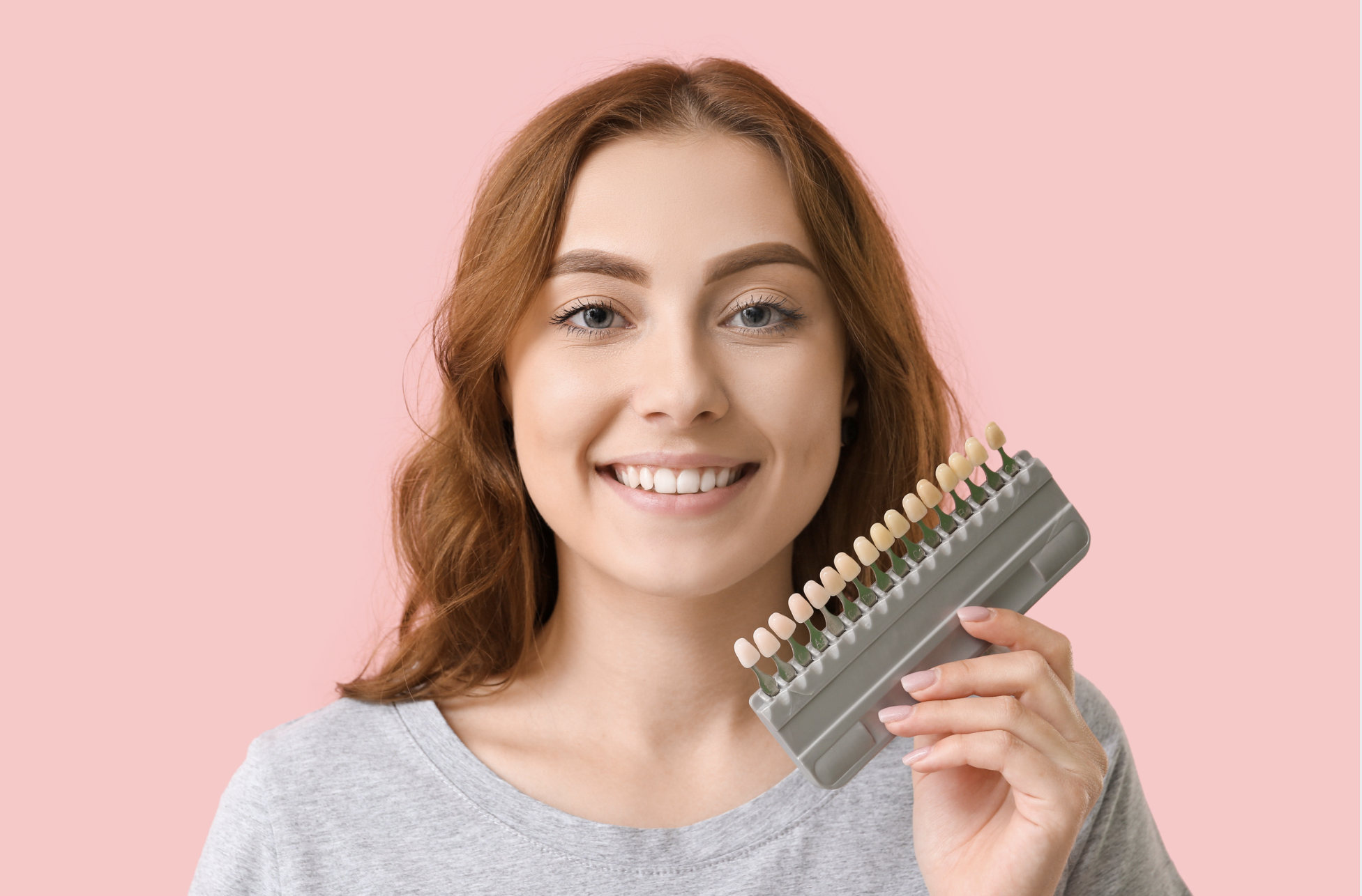 Can Porcelain Veneers Be Matched to Natural Teeth?