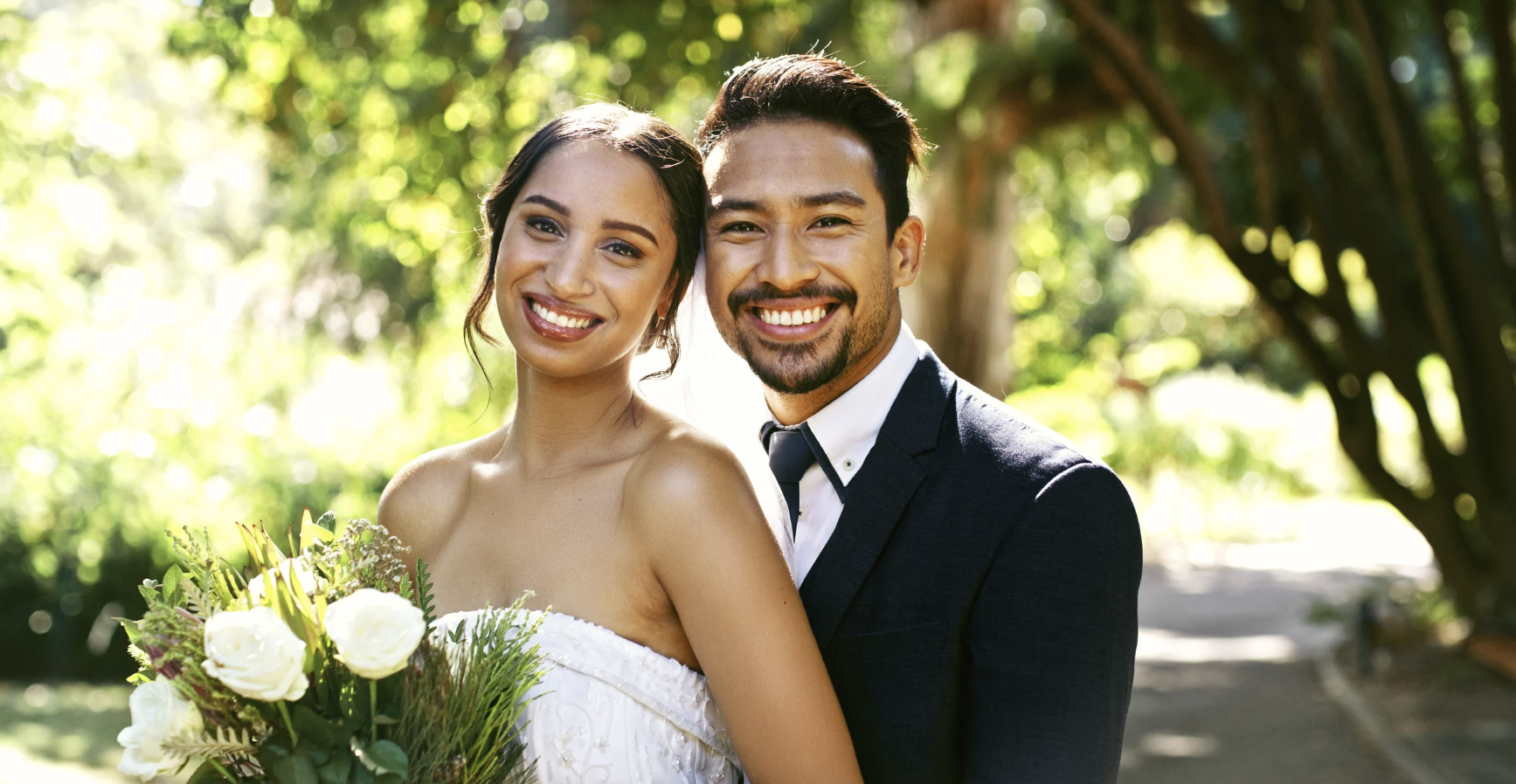 Wedding Smile Makeover in Austin, TX